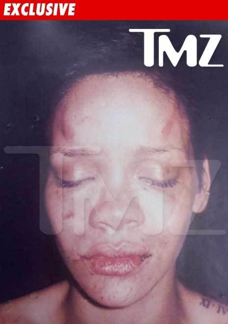 rihanna pictures after beating. Rihanna after beating